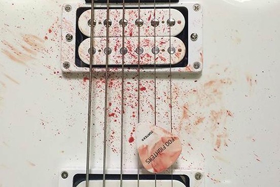 Foo Fighters anuncia su vuelta con sangrienta foto  1